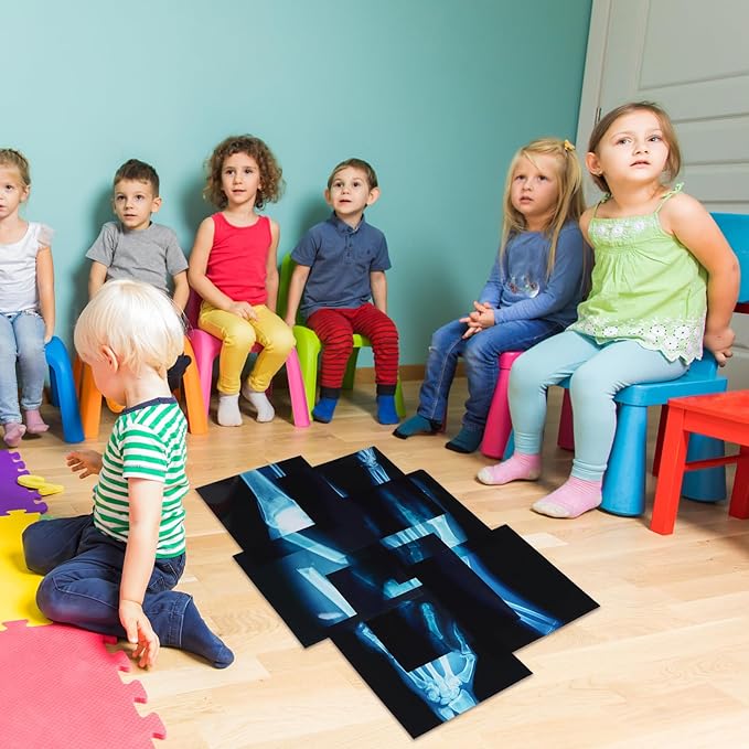 16 Pcs Realistic Broken Bones X-Ray Set - Blue & Black Skeleton X-Rays for Kids (9.8"x9.8") - Pretend Play Doctor Kit Learning Toy, Halloween & Medical School Supplies