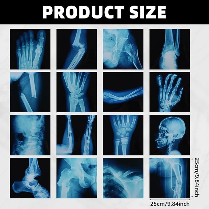 16 Pcs Realistic Broken Bones X-Ray Set - Blue & Black Skeleton X-Rays for Kids (9.8"x9.8") - Pretend Play Doctor Kit Learning Toy, Halloween & Medical School Supplies