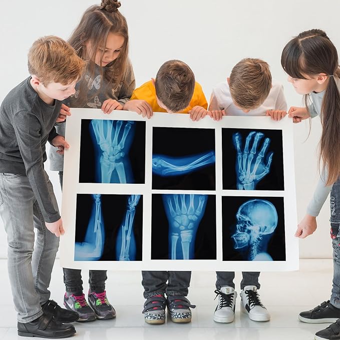 16 Pcs Realistic Broken Bones X-Ray Set - Blue & Black Skeleton X-Rays for Kids (9.8"x9.8") - Pretend Play Doctor Kit Learning Toy, Halloween & Medical School Supplies
