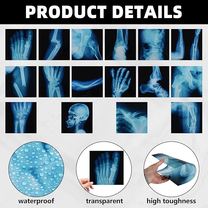 16 Pcs Realistic Broken Bones X-Ray Set - Blue & Black Skeleton X-Rays for Kids (9.8"x9.8") - Pretend Play Doctor Kit Learning Toy, Halloween & Medical School Supplies
